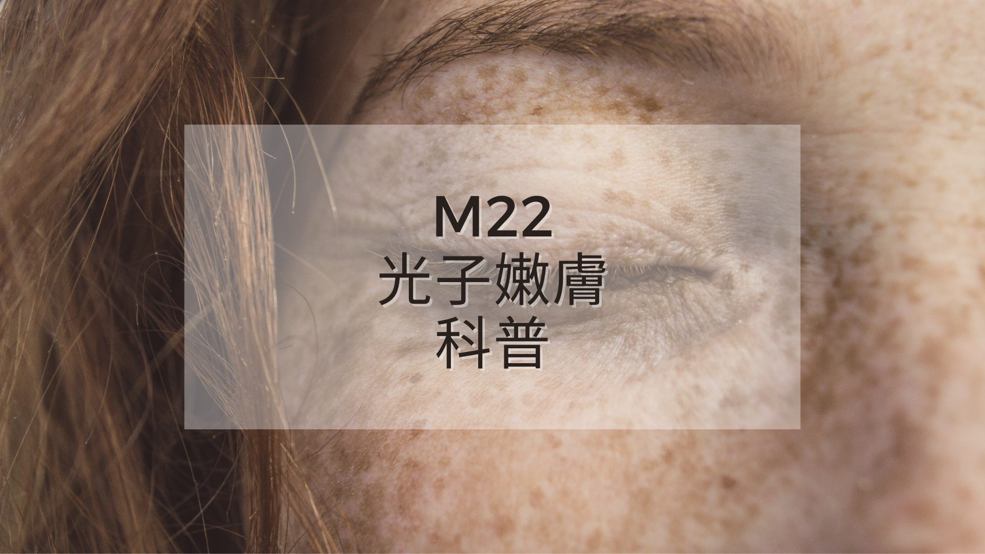 You are currently viewing M22光子嫩膚科普